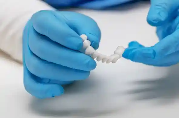 Innovative Dental Bridges: No More Reliance on Adjacent Teeth